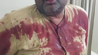 Photo of Sonbhadra News- अधिवक्ता के साथ मार पीट करने वाले पुलिस अधिकारी को बर्खास्त कर कठोर करवाई करे सरकार–राकेश शरण मिश्र